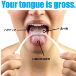 郷ひろみ愛用の舌ブラシ『ブレスRX』どこに売ってる？口臭対策には舌クリーナー！